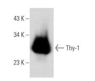 Thy-1/CD90 Antibody (2Q1792) - Western Blotting - Image 353681