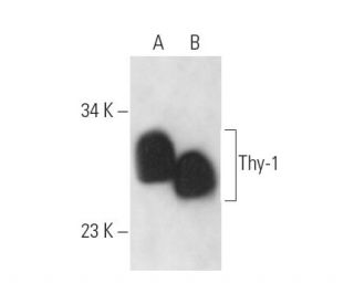 Thy-1/CD90 Antibody (YBM29/21) - Western Blotting - Image 14272 