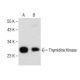 Thymidine Kinase Antibody (C-4) - Western Blotting - Image 282536 