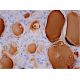 Thyroglobulin Antibody (1D4) - Immunohistochemistry - Image 293418 