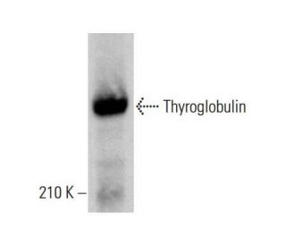 Thyroglobulin Antibody (2H11) - Western Blotting - Image 382222 