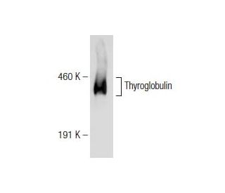 Thyroglobulin Antibody (D-9) - Western Blotting - Image 146833 