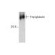 Thyroglobulin Antibody (F-7) - Western Blotting - Image 351853