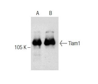 Tiam1 Antibody (F-11) - Western Blotting - Image 283648 