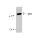 Tiam1 Antibody (G-1) - Western Blotting - Image 378683