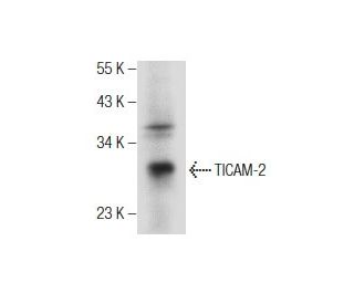 TICAM-2 Antibody (G-6) - Western Blotting - Image 155314