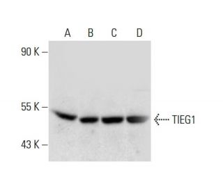 TIEG1 Antibody (95-D) - Western Blotting - Image 139032Each CRISPR/Cas9 Knockout (KO) Plasmid product consists of a pool of 3 plasmids designed to ensure identification and cleavage of a specific gene for maximum knockout efficiency. Each plasmid encodes a unique 20 nt sequence derived from the GeCKO (v2) library. 