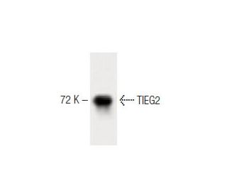 TIEG2 Antibody (32) - Western Blotting - Image 60472 