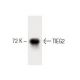 TIEG2 Antibody (32) - Western Blotting - Image 60472 