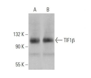 TIF1β Antibody (D-7) - Western Blotting - Image 375895Each CRISPR/Cas9 Knockout (KO) Plasmid product consists of a pool of 3 plasmids designed to ensure identification and cleavage of a specific gene for maximum knockout efficiency. Each plasmid encodes a unique 20 nt sequence derived from the GeCKO (v2) library.