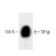 TIF1β Antibody (23) - Western Blotting - Image 60473 