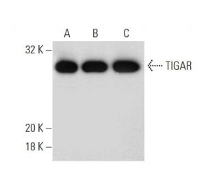 TIGAR Antibody (E-2) - Western Blotting - Image 139646 