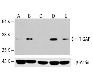 TIGAR Antibody (E-10) - Western Blotting - Image 413654 