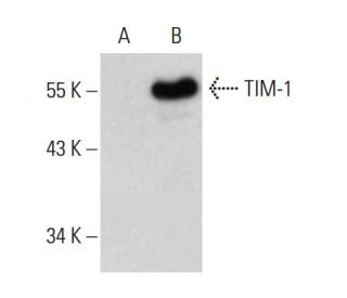 TIM-1 Antibody (A-12) - Western Blotting - Image 385349Each CRISPR/Cas9 Knockout (KO) Plasmid product consists of a pool of 3 plasmids designed to ensure identification and cleavage of a specific gene for maximum knockout efficiency. Each plasmid encodes a unique 20 nt sequence derived from the GeCKO (v2) library.