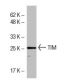 TIM Antibody (BB-7) - Western Blotting - Image 33913 