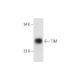 TIM Antibody (BB-7) - Western Blotting - Image 80651
