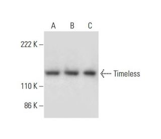 Timeless Antibody (G-4) - Western Blotting - Image 294104 