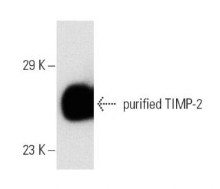TIMP-2 Antibody (3A4) - Western Blotting - Image 3878 