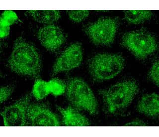 TIMP-2 Antibody (B-12) - Immunofluorescence - Image 145483 