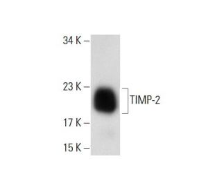 TIMP-2 Antibody (H-4) - Western Blotting - Image 134156 