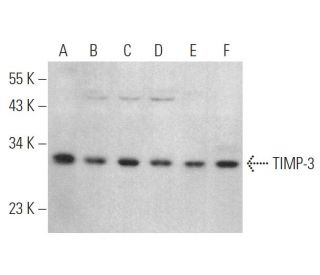 TIMP-3 Antibody (E-2) - Western Blotting - Image 375094The Double Nickase Plasmid features a U6 promoter for sgRNA expression, a 20 nt targeting sequence, and a gRNA scaffold to guide Cas9n. It includes a CBh promoter for Cas9n (D10A) and puromycin resistance, GFP for transfection verification, and nuclear localization signals (NLS). The 2A peptide allows co-expression of Cas9n and Puro from a single promoter, enabling precise genome editing with reduced off-target effects.