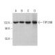 TIP120B Antibody (H-7) - Western Blotting - Image 382295 