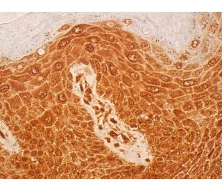 TIP60 Antibody (T4D2) - Immunohistochemistry - Image 411720