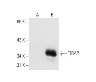 TIRAP Antibody (B-3) - Western Blotting - Image 66401
