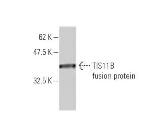 TIS11B Antibody (1A3) - Western Blotting - Image 348445Each CRISPR/Cas9 Knockout (KO) Plasmid product consists of a pool of 3 plasmids designed to ensure identification and cleavage of a specific gene for maximum knockout efficiency. Each plasmid encodes a unique 20 nt sequence derived from the GeCKO (v2) library.