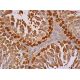 TKTL1/2 Antibody (E-8) - Immunohistochemistry - Image 386803 