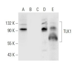 TLK1 Antibody (G-8) - Western Blotting - Image 296014