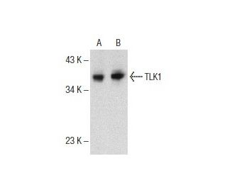 TLK1 Antibody (S-32) - Western Blotting - Image 153943 