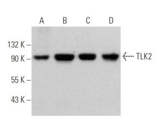 TLK2 Antibody (E-12) - Western Blotting - Image 365994 