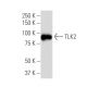 TLK2 Antibody (Y-17) - Western Blotting - Image 33721 