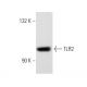 TLR2 Antibody (TL2.1) - Western Blotting - Image 32738