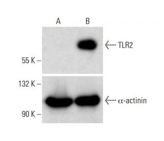 TLR2 Antibody (A-9) - Western Blotting - Image 321859