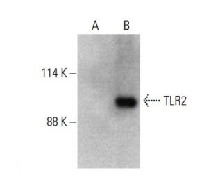 TLR2 (A-9): sc-166900. Western blot analysis of TLR2 expression in... 