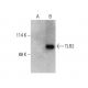 TLR2 (A-9): sc-166900. Western blot analysis of TLR2 expression in... 