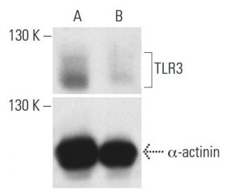 TLR3 siRNA (h): sc-36685. Western blot analysis of TLR3 expression in non-transfected control (A) and TLR3 siRNA transfect 