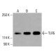 TLR5抗體(H-11):sc-518106。Western blot分析HeLa(A)、K-562(B)及HCT-116(C)全細胞裂解液中TLR5之表現。檢測試劑:m-IgGκ BP-HRP:sc-516102。 TLR5 Antibody (H-11) - Western Blotting - Image 416146