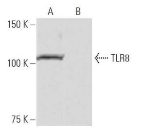 TLR8 Antibody (9A6) - Western Blotting - Image 65077Each CRISPR/Cas9 Knockout (KO) Plasmid product consists of a pool of 3 plasmids designed to ensure identification and cleavage of a specific gene for maximum knockout efficiency. Each plasmid encodes a unique 20 nt sequence derived from the GeCKO (v2) library.