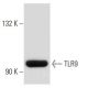 TLR9 Antibody (26C593) - Western Blotting - Image 32742 