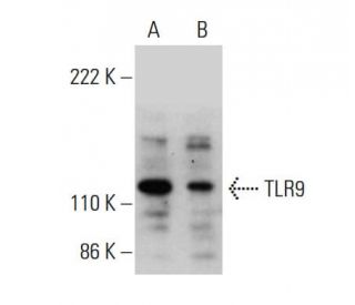 TLR9 Antibody (F-3) - Western Blotting - Image 377906 