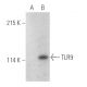 TLR9 Antibody (F-3) - Western Blotting - Image 389893
