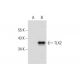 TLX2 Antibody (D-12) - Western Blotting - Image 314478