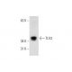 TLX3 Antibody (34-L) - Western Blotting - Image 70329 