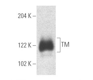 TM Antibody (D-3) - Western Blotting - Image 4972 