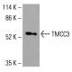 Galectin-3 抗体(F-8):sc-515582。Western blot 分析未处理(A)和化学处理(B)的 HCT-116 完整细胞裂解物中 Galectin-3 的表达。使用的检测试剂:m-IgG2b BP-HRP:sc-542741。β-肌动蛋白(C4):sc-47778 用作加载对照。使用的检测试剂:m-IgG Fc BP-HRP:sc-525409。 TMCC3 Antibody (D-6) - Western Blotting - Image 416050