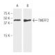TMEFF2 Antibody (J4B6) - Western Blotting - Image 62772