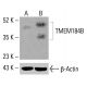TMEM184B Antibody (A-6) - Western Blotting - Image 416004